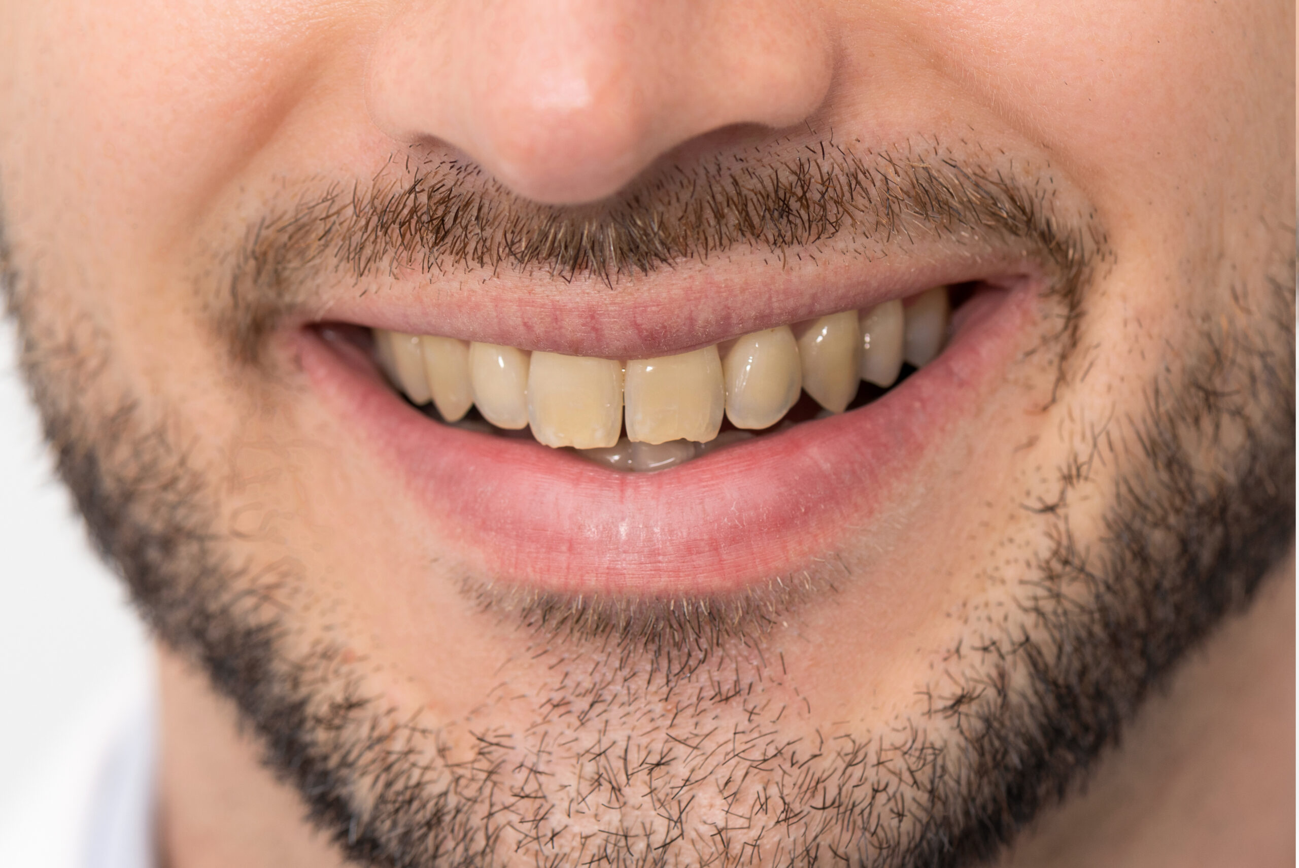 before image - apr dental