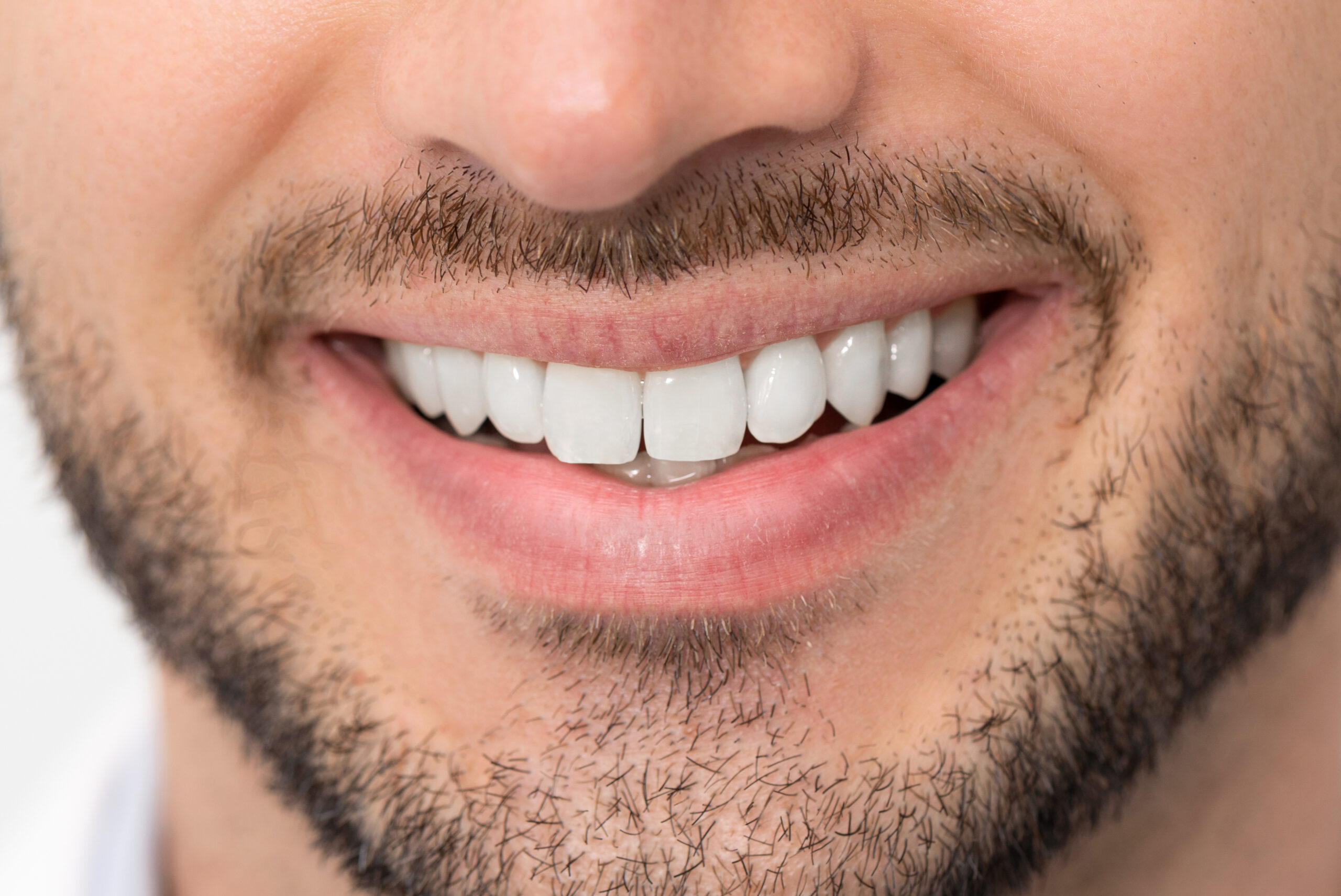 after image - apr dental